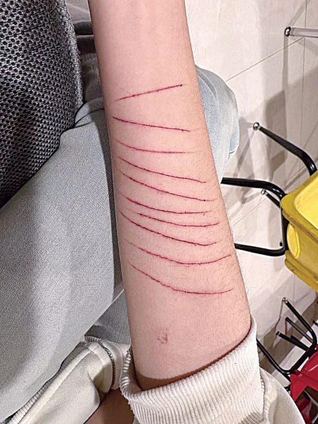 法拉盛13岁华裔少女遭恶性霸凌，被逼持刀自伤